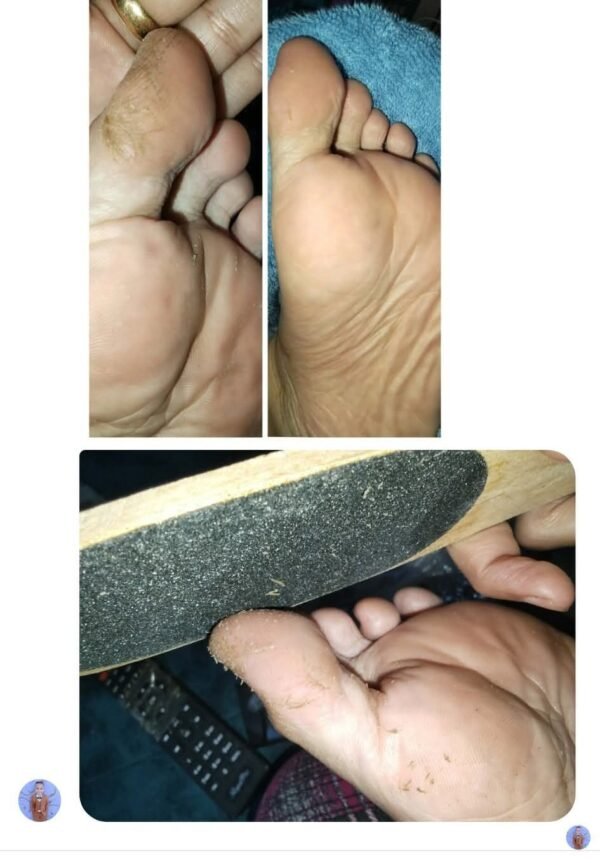 مجموعة الباديكير