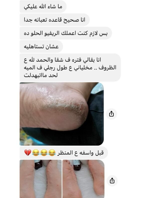 مجموعة الباديكير