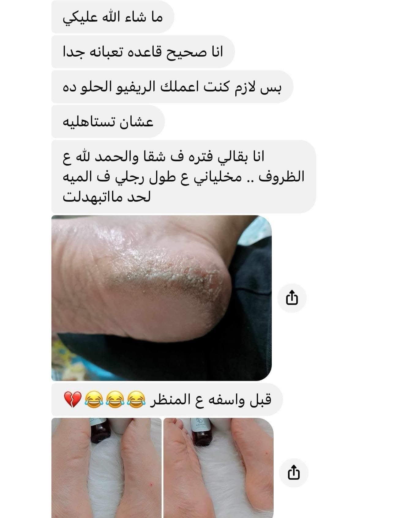 مجموعة الباديكير 4 مجموعة الباديكير - الصورة 4