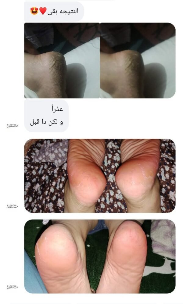 مجموعة الباديكير